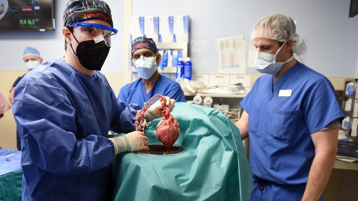 Zemřel pacient s transplantovaným prasečím srdcem